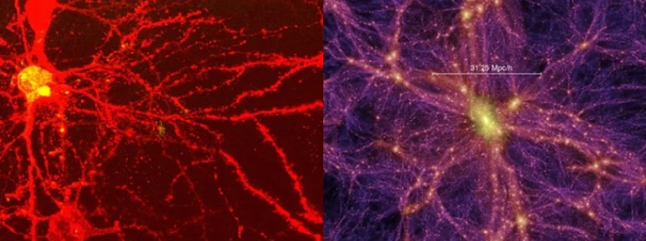 Study Maps The Odd Structural Similarities Between The Human Brain And The Universe 
